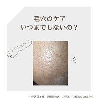 画像541