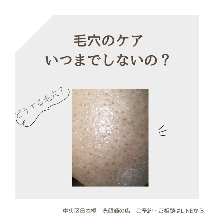 画像541