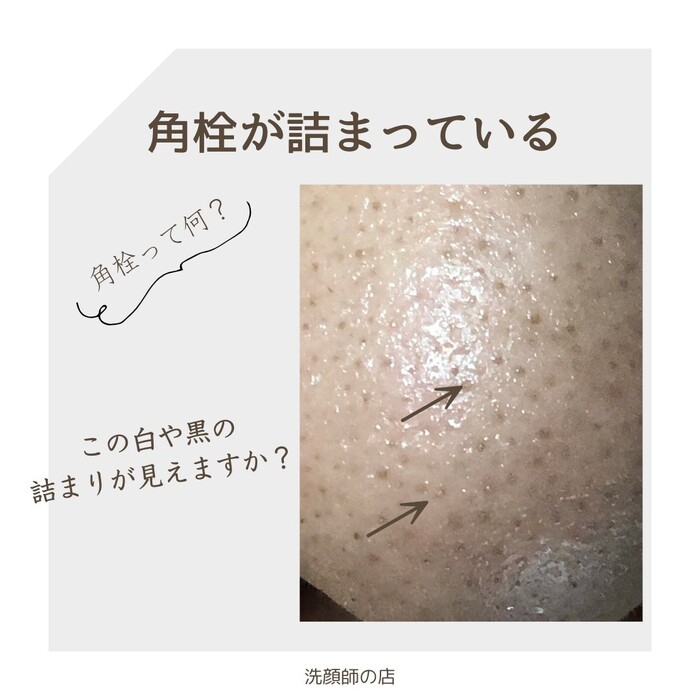 画像542
