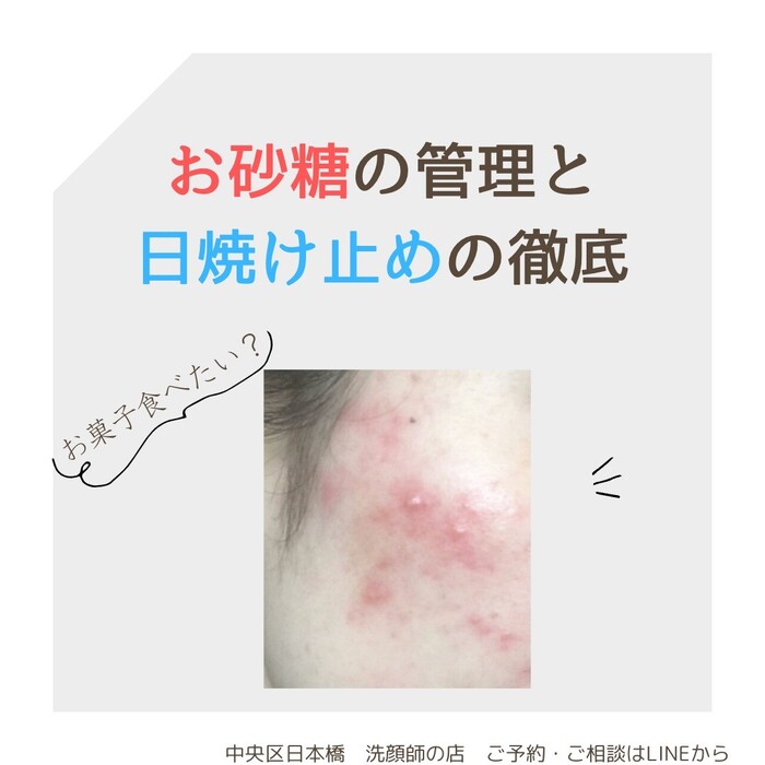 画像557