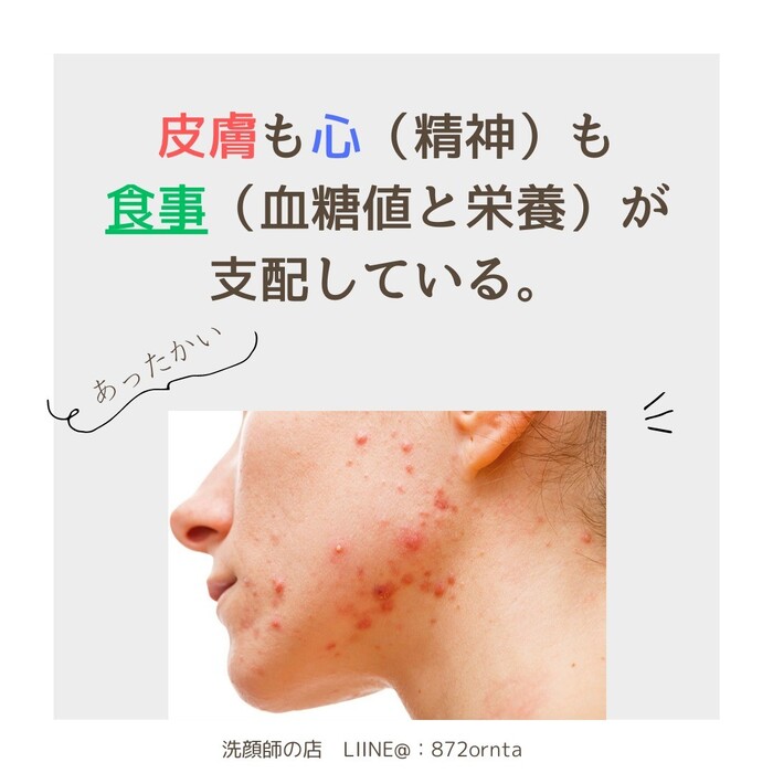 画像614