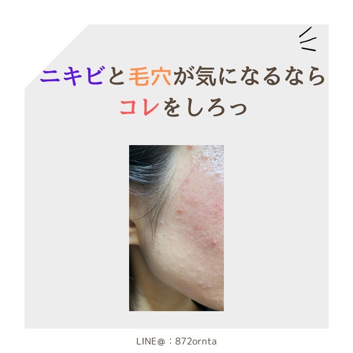 画像622